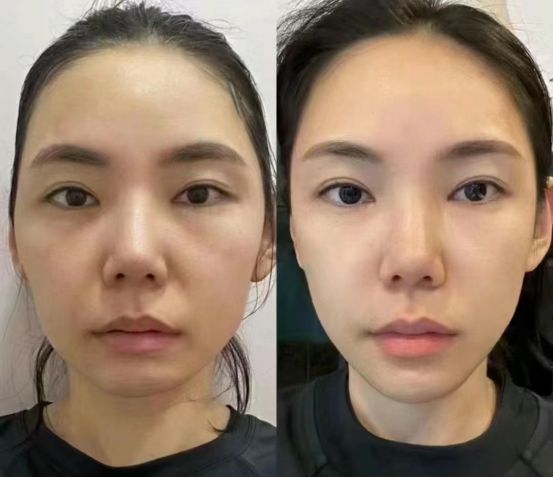 024最值得入手的抗皱国货分享OG网站抗老去皱纹护肤品推荐2